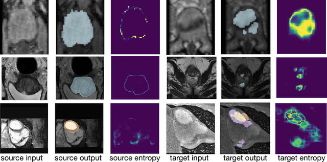 Figure 1 for Source-Free Domain Adaptation for Image Segmentation