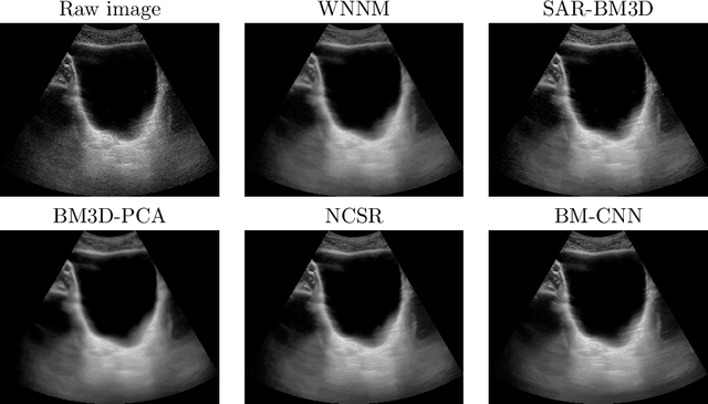 Figure 3 for A Universal Deep Learning Framework for Real-Time Denoising of Ultrasound Images