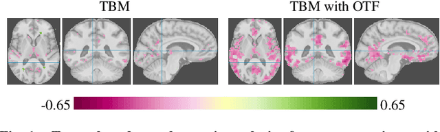 Figure 1 for Optimal Transport Features for Morphometric Population Analysis