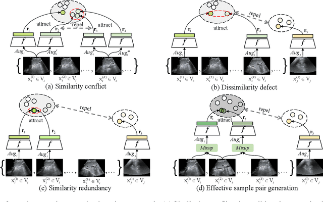 Figure 1 for Effective Sample Pair Generation for Ultrasound Video Contrastive Representation Learning