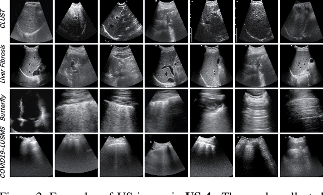 Figure 3 for Effective Sample Pair Generation for Ultrasound Video Contrastive Representation Learning