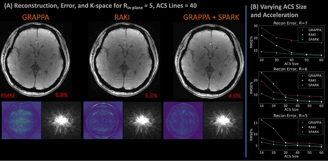 Figure 3 for Scan Specific Artifact Reduction in K-space  Neural Networks Synergize with Physics-based Reconstruction to Accelerate MRI