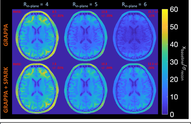 Figure 4 for Scan Specific Artifact Reduction in K-space  Neural Networks Synergize with Physics-based Reconstruction to Accelerate MRI