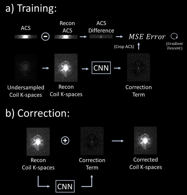 Figure 1 for Scan Specific Artifact Reduction in K-space  Neural Networks Synergize with Physics-based Reconstruction to Accelerate MRI