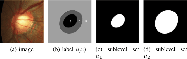 Figure 2 for Convex Shape Prior for Deep Neural Convolution Network based Eye Fundus Images Segmentation