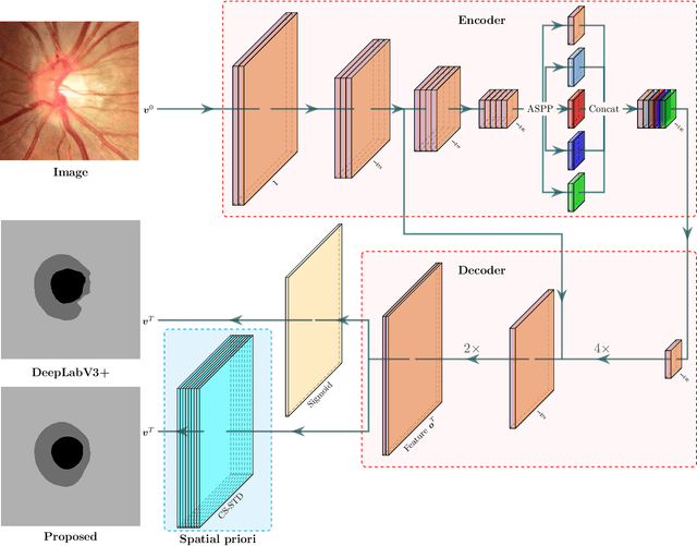 Figure 3 for Convex Shape Prior for Deep Neural Convolution Network based Eye Fundus Images Segmentation