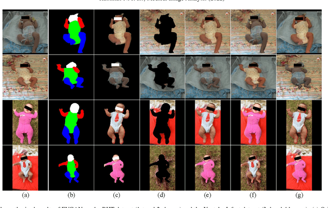 Figure 1 for Semi-supervised Body Parsing and Pose Estimation for Enhancing Infant General Movement Assessment