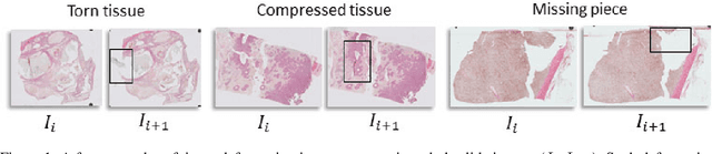 Figure 1 for Regional Registration of Whole Slide Image Stacks Containing Highly Deformed Artefacts