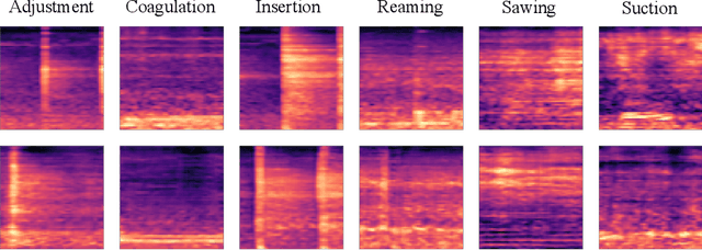 Figure 4 for Conditional Generative Data Augmentation for Clinical Audio Datasets