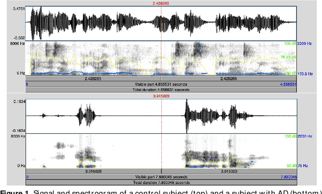 Figure 1 for Multi-class versus One-class classifier in spontaneous speech analysis oriented to Alzheimer Disease diagnosis