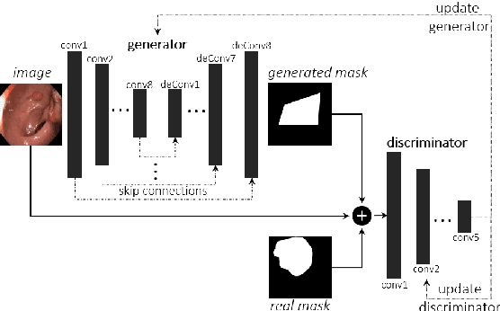 Figure 1 for Explainable Medical Image Segmentation via Generative Adversarial Networks and Layer-wise Relevance Propagation