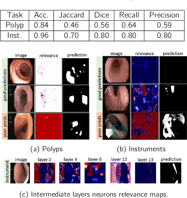 Figure 3 for Explainable Medical Image Segmentation via Generative Adversarial Networks and Layer-wise Relevance Propagation