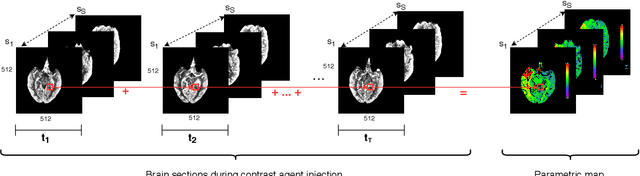 Figure 2 for CNN Based Segmentation of Infarcted Regions in Acute Cerebral Stroke Patients From Computed Tomography Perfusion Imaging