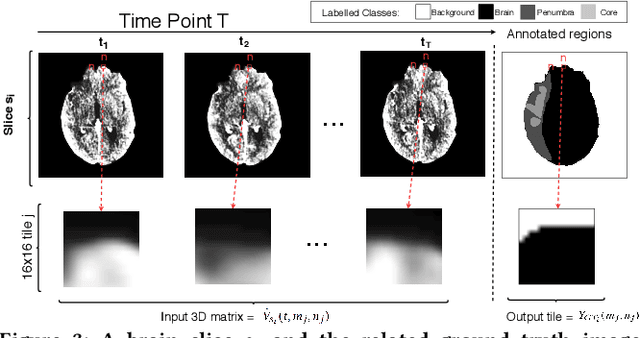 Figure 4 for CNN Based Segmentation of Infarcted Regions in Acute Cerebral Stroke Patients From Computed Tomography Perfusion Imaging