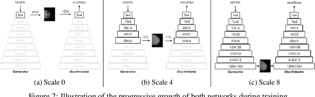 Figure 2 for High-Resolution Mammogram Synthesis using Progressive Generative Adversarial Networks