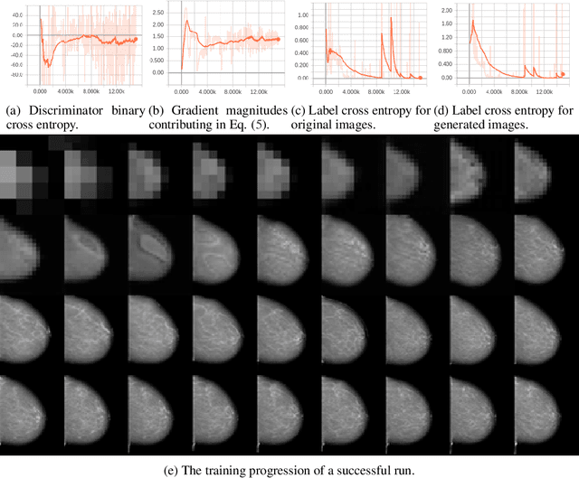 Figure 3 for High-Resolution Mammogram Synthesis using Progressive Generative Adversarial Networks