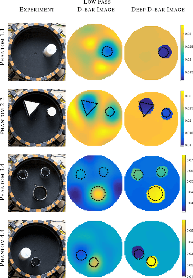 Figure 4 for Deep D-bar: Real time Electrical Impedance Tomography Imaging with Deep Neural Networks