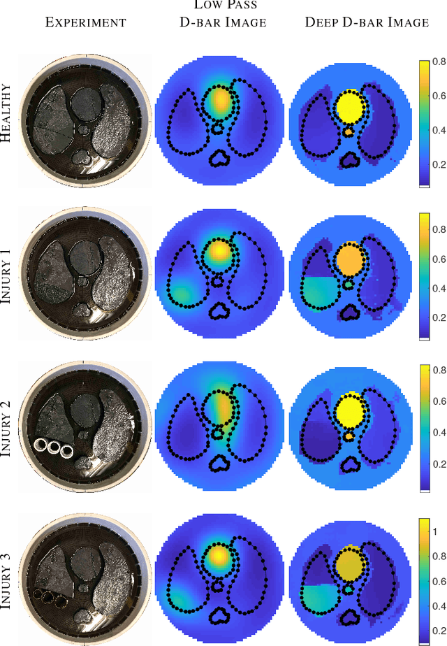Figure 2 for Deep D-bar: Real time Electrical Impedance Tomography Imaging with Deep Neural Networks