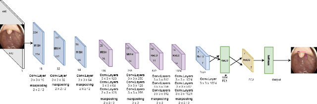 Figure 3 for A Deep Convolutional Neural Network for the Detection of Polyps in Colonoscopy Images