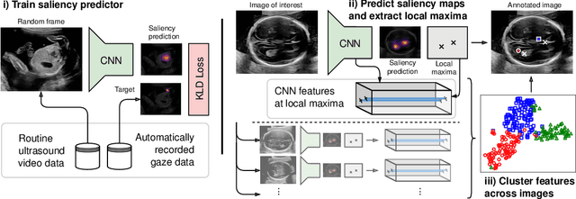 Figure 1 for Discovering Salient Anatomical Landmarks by Predicting Human Gaze