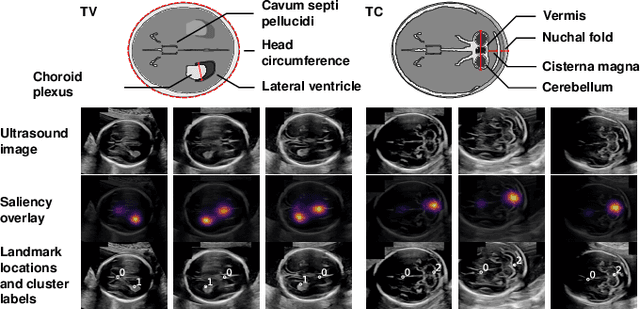 Figure 3 for Discovering Salient Anatomical Landmarks by Predicting Human Gaze
