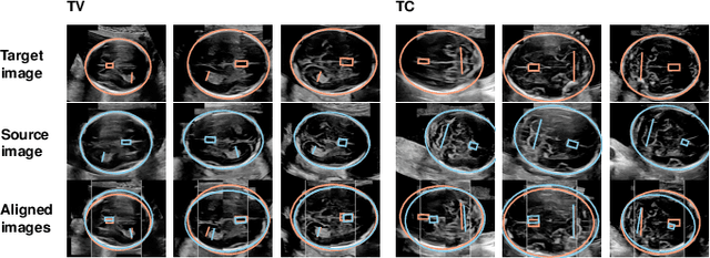 Figure 4 for Discovering Salient Anatomical Landmarks by Predicting Human Gaze