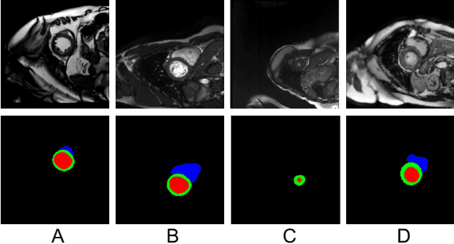 Figure 1 for Enhancing Pseudo Label Quality for Semi-SupervisedDomain-Generalized Medical Image Segmentation