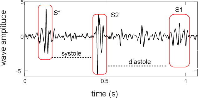 Figure 1 for Heart Sound Segmentation using Bidirectional LSTMs with Attention