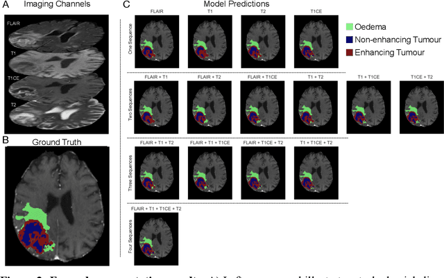 Figure 2 for Translating automated brain tumour phenotyping to clinical neuroimaging
