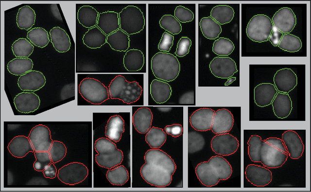 Figure 2 for Seed-Point Based Geometric Partitioning of Nuclei Clumps