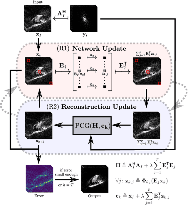 Figure 1 for Unsupervised Adaptive Neural Network Regularization for Accelerated Radial Cine MRI