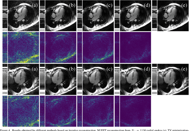 Figure 3 for Unsupervised Adaptive Neural Network Regularization for Accelerated Radial Cine MRI