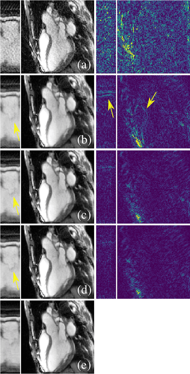 Figure 4 for Unsupervised Adaptive Neural Network Regularization for Accelerated Radial Cine MRI
