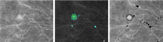 Figure 3 for Reducing Anomaly Detection in Images to Detection in Noise