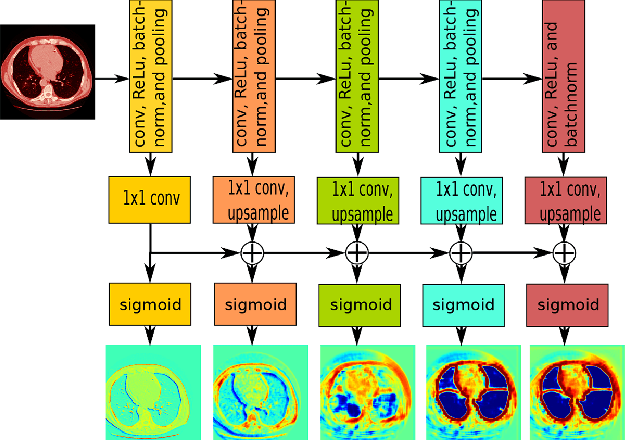 Figure 2 for Pathological Pulmonary Lobe Segmentation from CT Images using Progressive Holistically Nested Neural Networks and Random Walker