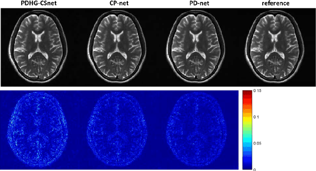 Figure 2 for Model Learning: Primal Dual Networks for Fast MR imaging