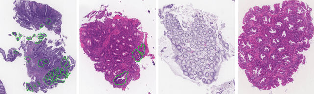 Figure 1 for Redesigning Fully Convolutional DenseUNets for Large Histopathology Images