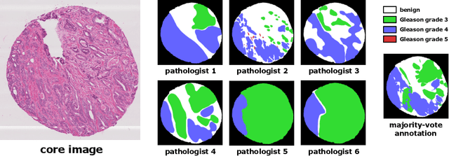 Figure 3 for Redesigning Fully Convolutional DenseUNets for Large Histopathology Images