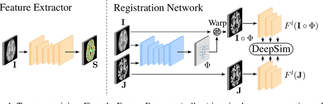 Figure 1 for DeepSim: Semantic similarity metrics for learned image registration