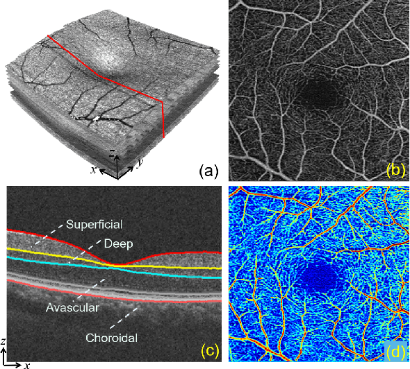 Figure 1 for 3D Vessel Reconstruction in OCT-Angiography via Depth Map Estimation