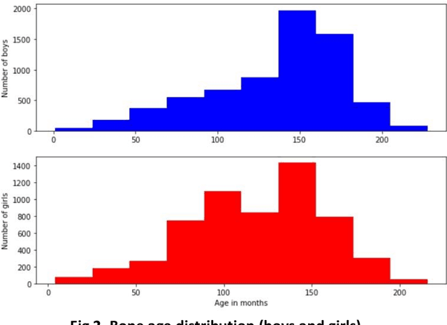 Figure 3 for Pediatric Bone Age Assessment using Deep Learning Models
