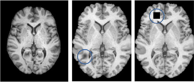 Figure 1 for Feature visualization for convolutional neural network models trained on neuroimaging data
