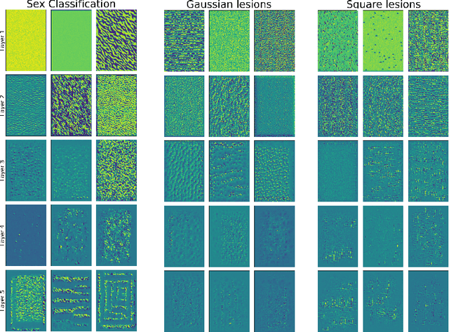 Figure 3 for Feature visualization for convolutional neural network models trained on neuroimaging data