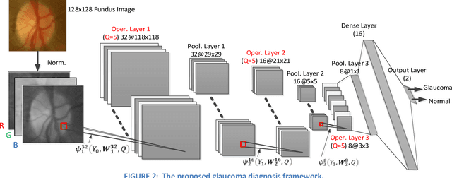 Figure 2 for Real-Time Glaucoma Detection from Digital Fundus Images using Self-ONNs