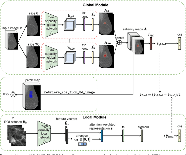 Figure 1 for 3D-GMIC: an efficient deep neural network to find small objects in large 3D images