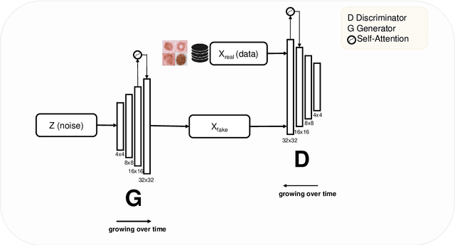 Figure 3 for Data Augmentation for Skin Lesion using Self-Attention based Progressive Generative Adversarial Network
