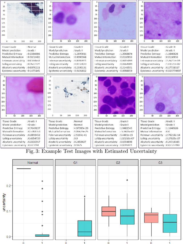 Figure 4 for Leveraging Uncertainty in Deep Learning for Pancreatic Adenocarcinoma Grading