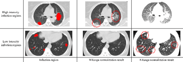 Figure 3 for COVID-19 Infection Segmentation from Chest CT Images Based on Scale Uncertainty
