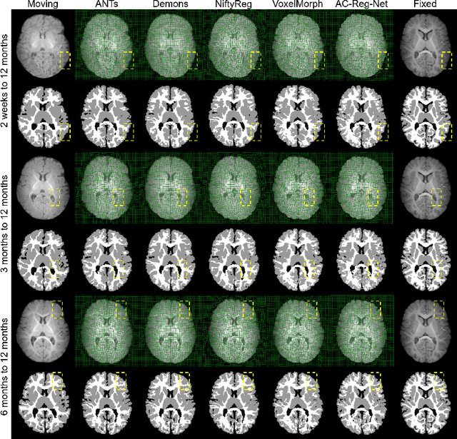 Figure 3 for An Auto-Context Deformable Registration Network for Infant Brain MRI