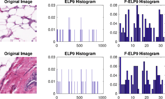 Figure 1 for A Compact Representation of Histopathology Images using Digital Stain Separation & Frequency-Based Encoded Local Projections